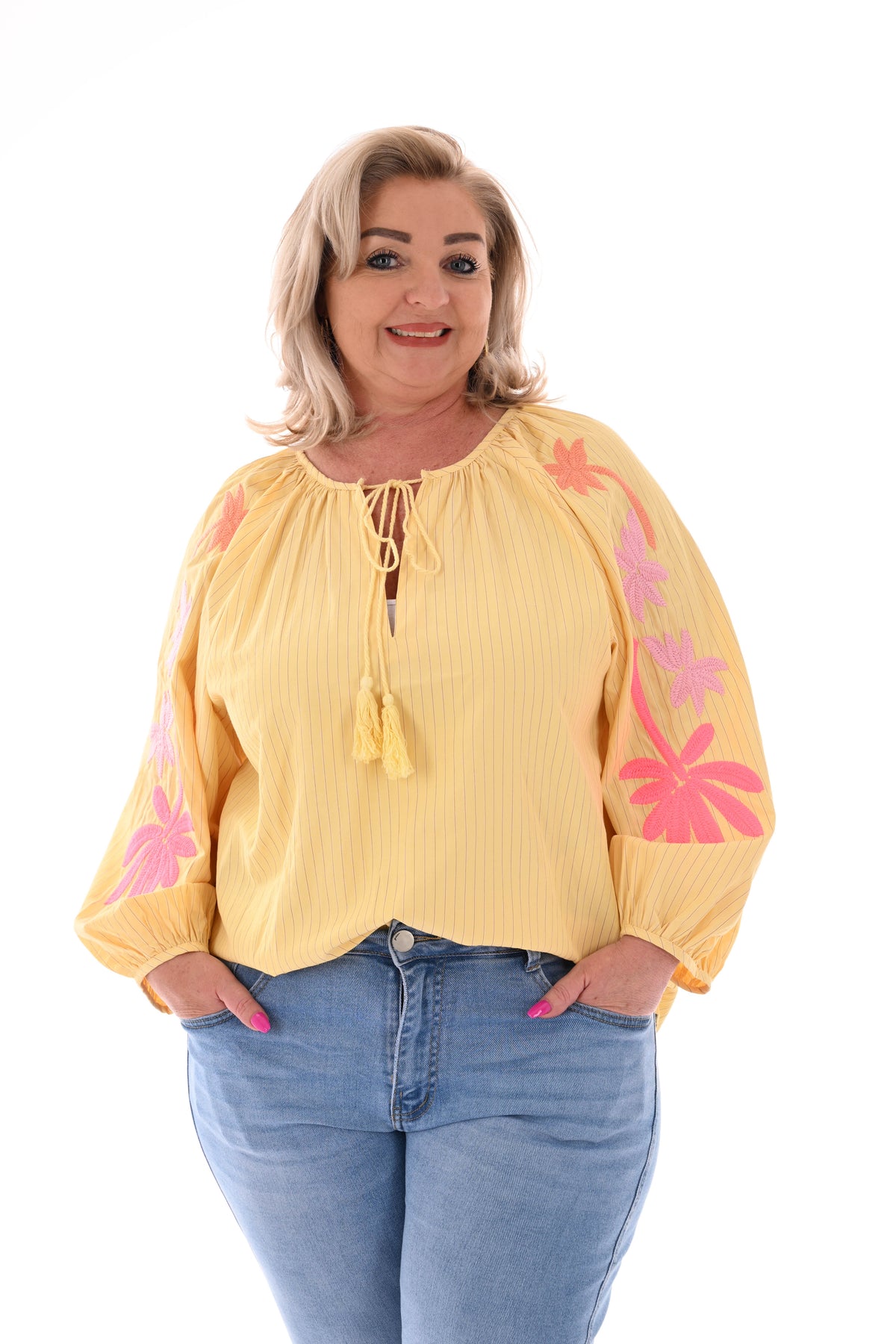 Top streepjes mouwdetails geel